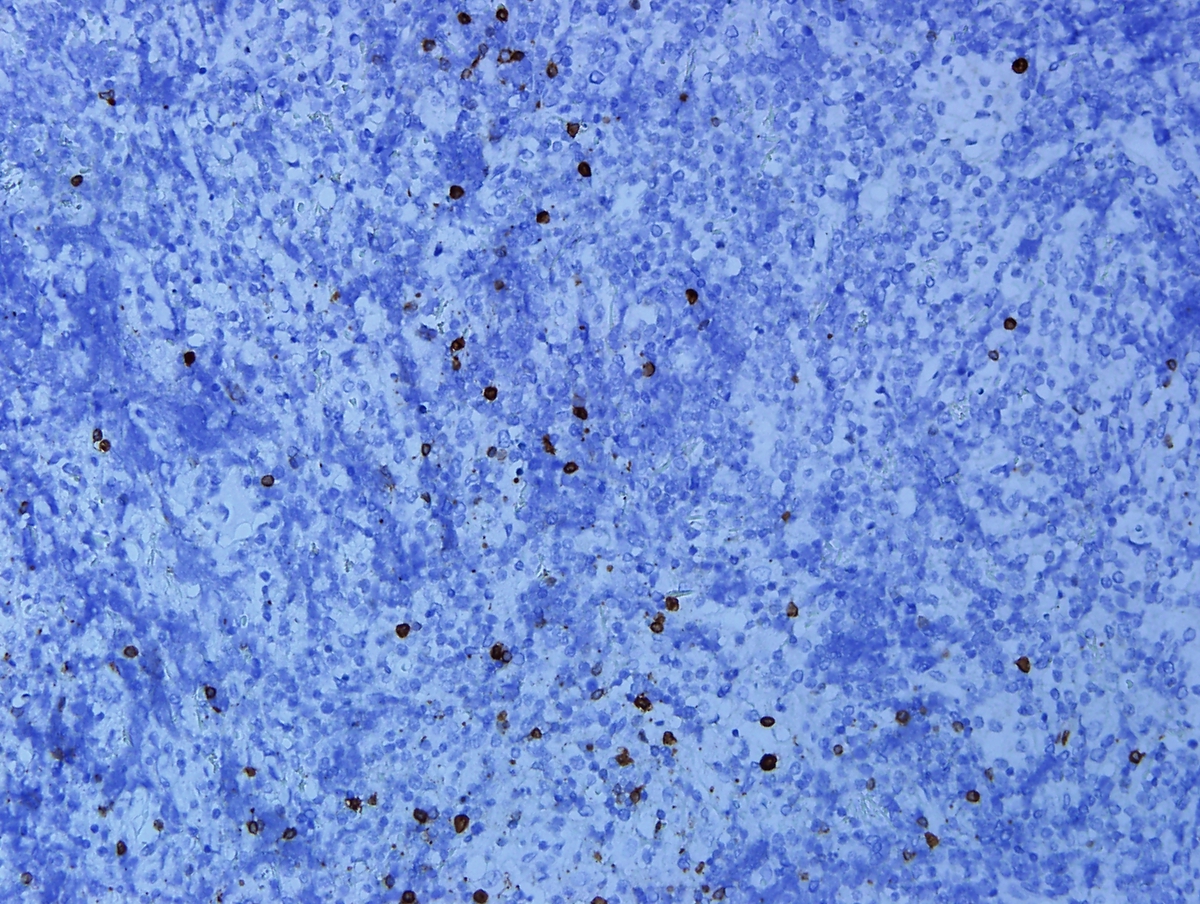 CD79a